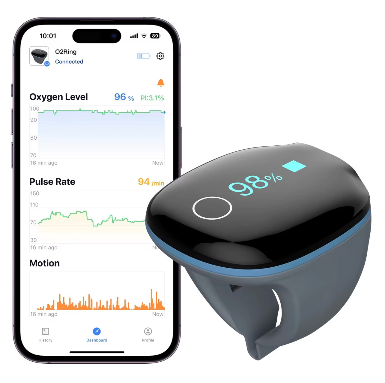 OxyRing Smart Monitor